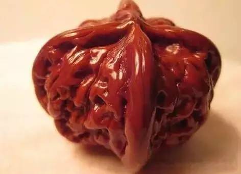 %title插图%num %title插图%num